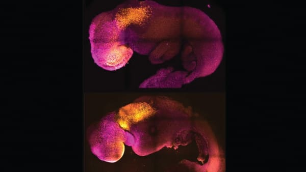 Synthetic embryos made without sperm or egg formed brain, beating heart